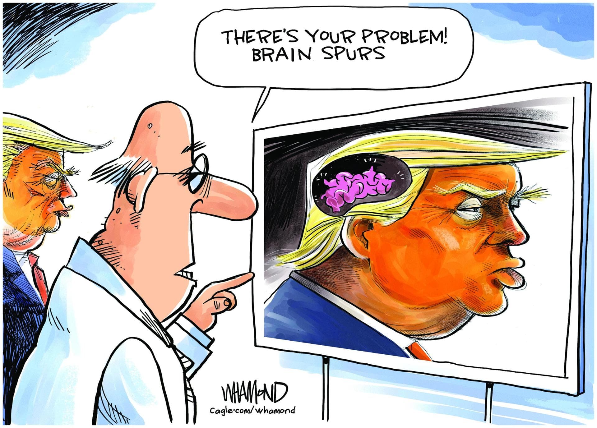 Trump health concerns