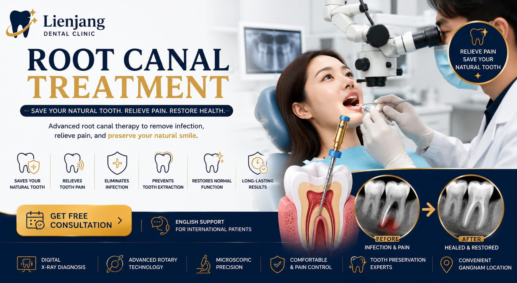 Root Canal Treatment at Lienjang Dental Clinic in Gangnam, Seoul